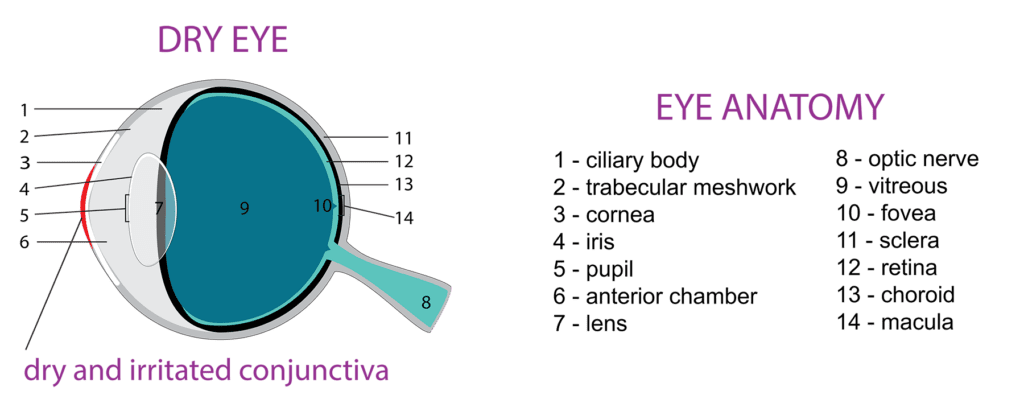 A diagram of human eye showing that dry eye impacts the cornea.